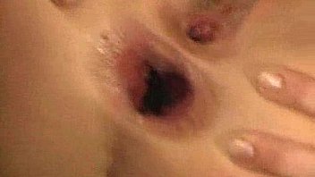 Anal gape 2 Anal gape 2