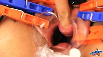 extreme medical torture enema speculum