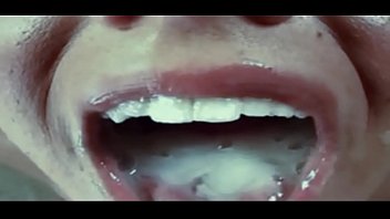 Oral fixation by bof