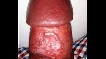 Penis examination