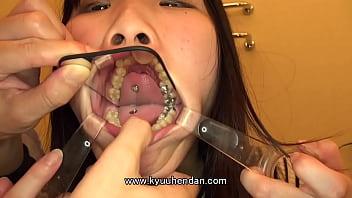 Compilation tooth mouth 01