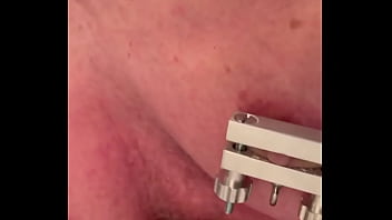 Upside down nipple pain Upside down nipple pain