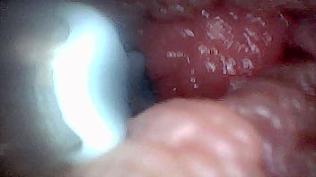 Visual guide to g spot stimulation and orgasm — endoscop perspective