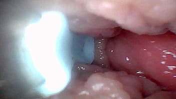 Visual guide to g spot stimulation and orgasm — endoscop perspective