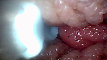 Visual guide to g spot stimulation and orgasm — endoscop perspective