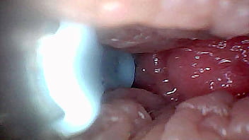 Visual guide to g spot stimulation and orgasm — endoscop perspective