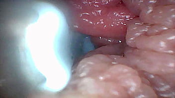 Visual guide to g spot stimulation and orgasm — endoscop perspective