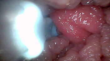 Visual guide to g spot stimulation and orgasm — endoscop perspective