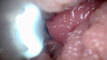 Visual guide to g spot stimulation and orgasm — endoscop perspective