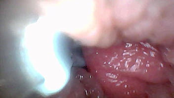 Visual guide to g spot stimulation and orgasm — endoscop perspective