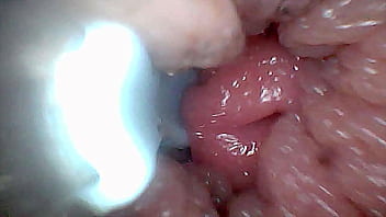 Visual guide to g spot stimulation and orgasm — endoscop perspective