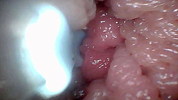 Visual guide to g spot stimulation and orgasm — endoscop perspective