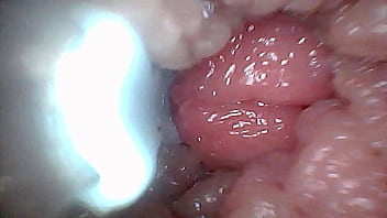 Visual guide to g spot stimulation and orgasm — endoscop perspective