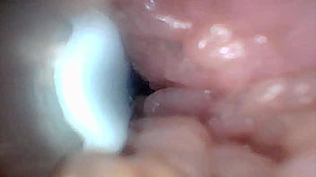 Visual guide to g spot stimulation and orgasm — endoscop perspective