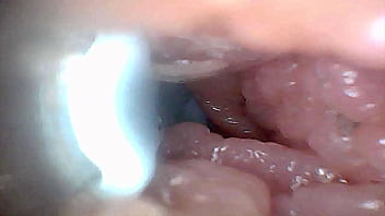 Visual guide to g spot stimulation and orgasm — endoscop perspective