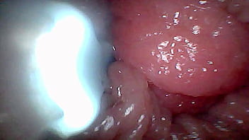 Visual guide to g spot stimulation and orgasm — endoscop perspective