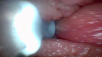 Visual guide to g spot stimulation and orgasm — endoscop perspective