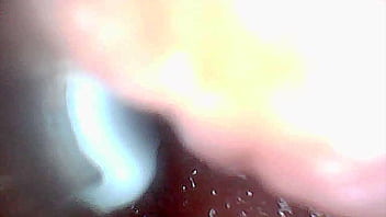 Visual guide to g spot stimulation and orgasm — endoscop perspective