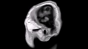 Structural mri animation