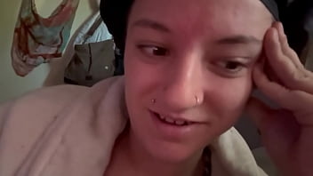 Just realized it’s been over a year since my breast cancer scare and my cool to watch boob biopsy