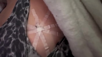 Just realized it’s been over a year since my breast cancer scare and my cool to watch boob biopsy Just realized it’s been over a year since my breast cancer scare and my cool to watch boob biopsy