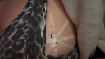 Just realized it’s been over a year since my breast cancer scare and my cool to watch boob biopsy