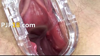 1 vibrating and opening her hole on terrace 2015 05 10 06 28 034