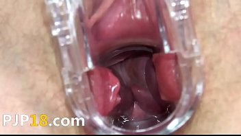 1 vibrating and opening her hole on terrace 2015 05 10 06 28 034