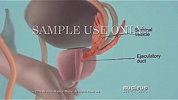 Semen analysis sperm count