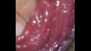 Big Prolapse Extreme thumbnail