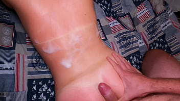 My stepsister got sunburned and asked for help short version