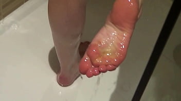 A back covered with moles