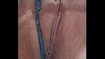 Mi extraordinaria zorra