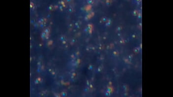 Examen de mis nadadores semen