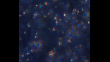 Examen de mis nadadores semen