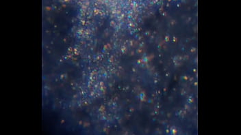 Examen de mis nadadores semen