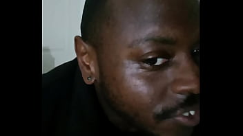 Introducing how my skin also gets sometimes when the weather gets hot and sunny in the summertime while wearing flasher coat to cover the rest of my body from developing too much allergies4