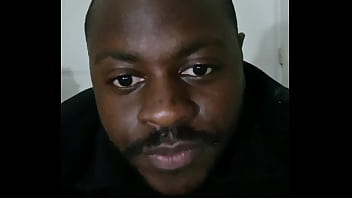 Introducing how my skin also gets sometimes when the weather gets hot and sunny in the summertime while wearing flasher coat to cover the rest of my body from developing too much allergies4