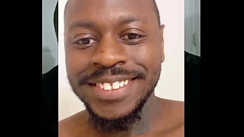 Introducing how my skin also gets sometimes when the weather gets hot and sunny in the summertime while wearing flasher coat to cover the rest of my body from developing too much allergies4