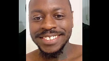 Introducing how my skin also gets sometimes when the weather gets hot and sunny in the summertime while wearing flasher coat to cover the rest of my body from developing too much allergies4