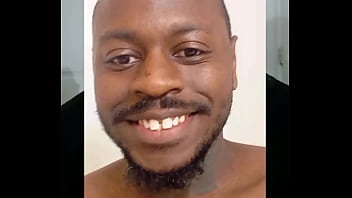 Introducing how my skin also gets sometimes when the weather gets hot and sunny in the summertime while wearing flasher coat to cover the rest of my body from developing too much allergies4