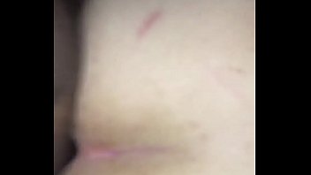 Light skin take down