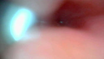 Endoscope camera captures moment of male ejaculation