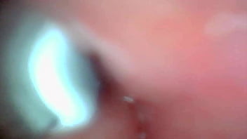 Endoscope camera captures moment of male ejaculation