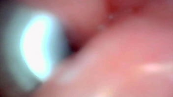 Endoscope camera captures moment of male ejaculation