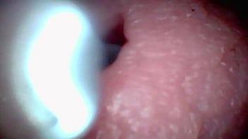 Endoscope camera captures moment of male ejaculation
