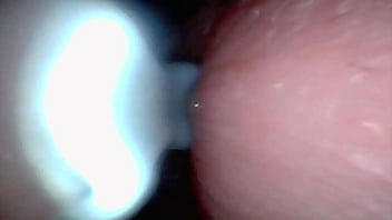 Endoscope camera captures moment of male ejaculation