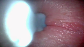 Endoscope camera captures moment of male ejaculation