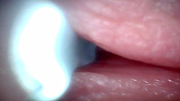 Endoscope camera captures moment of male ejaculation