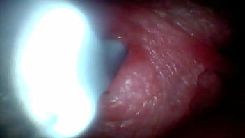 Endoscope camera captures moment of male ejaculation